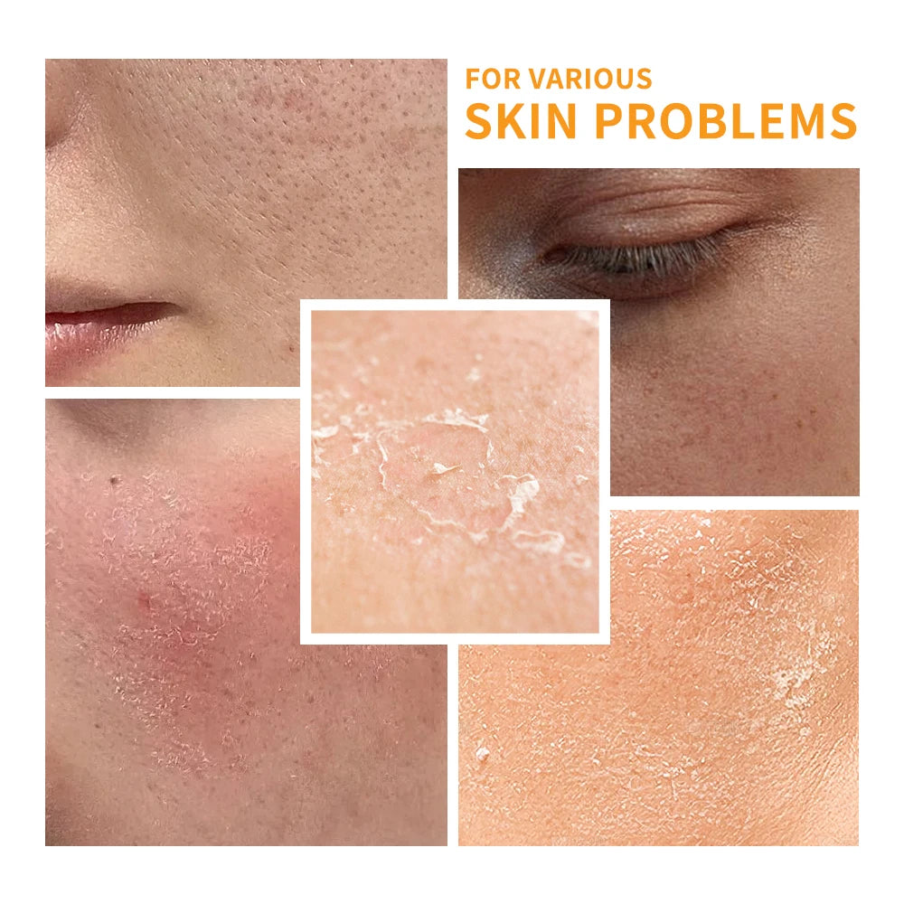 Lot Vitamin C Skin Care